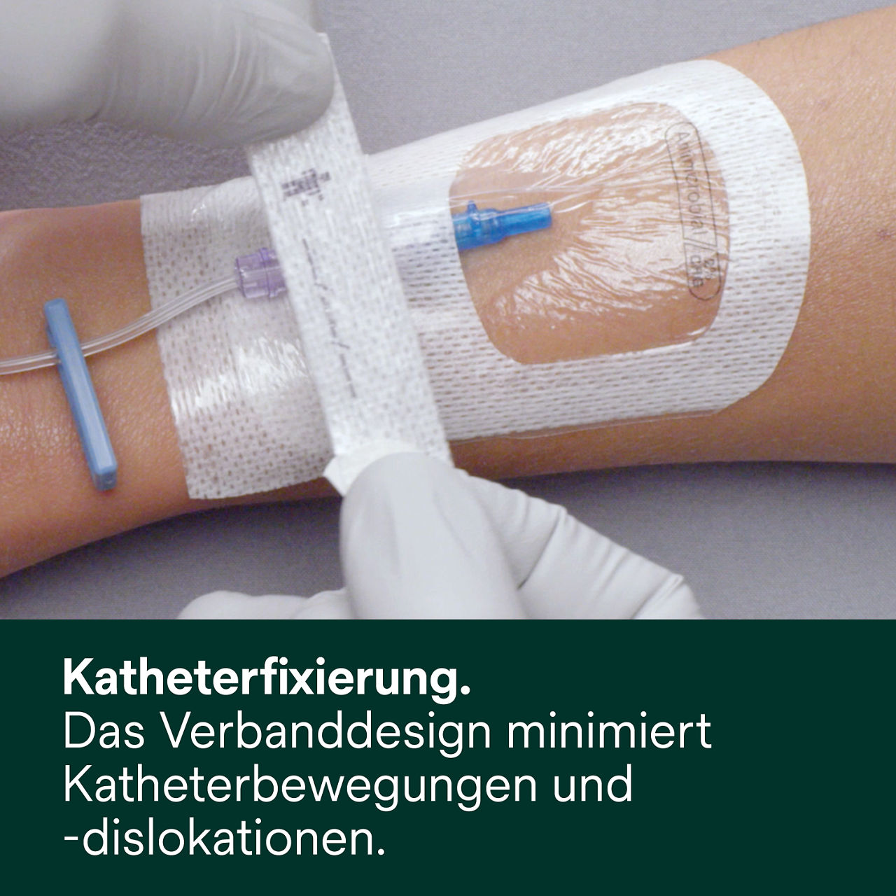 (5) Tegaderm 9132: Katheterfixierung