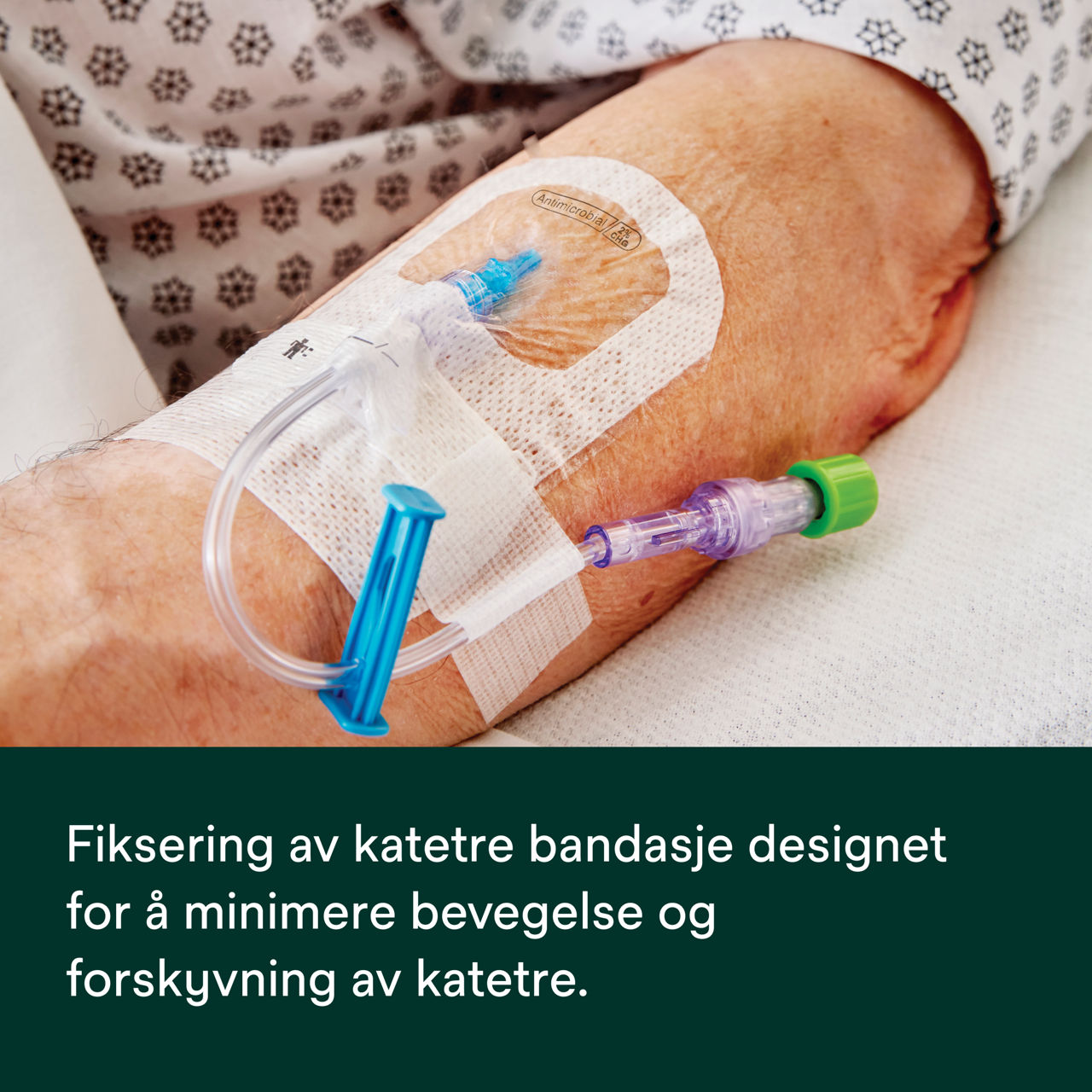 (5) Tegaderm 9132: Festing av kateter