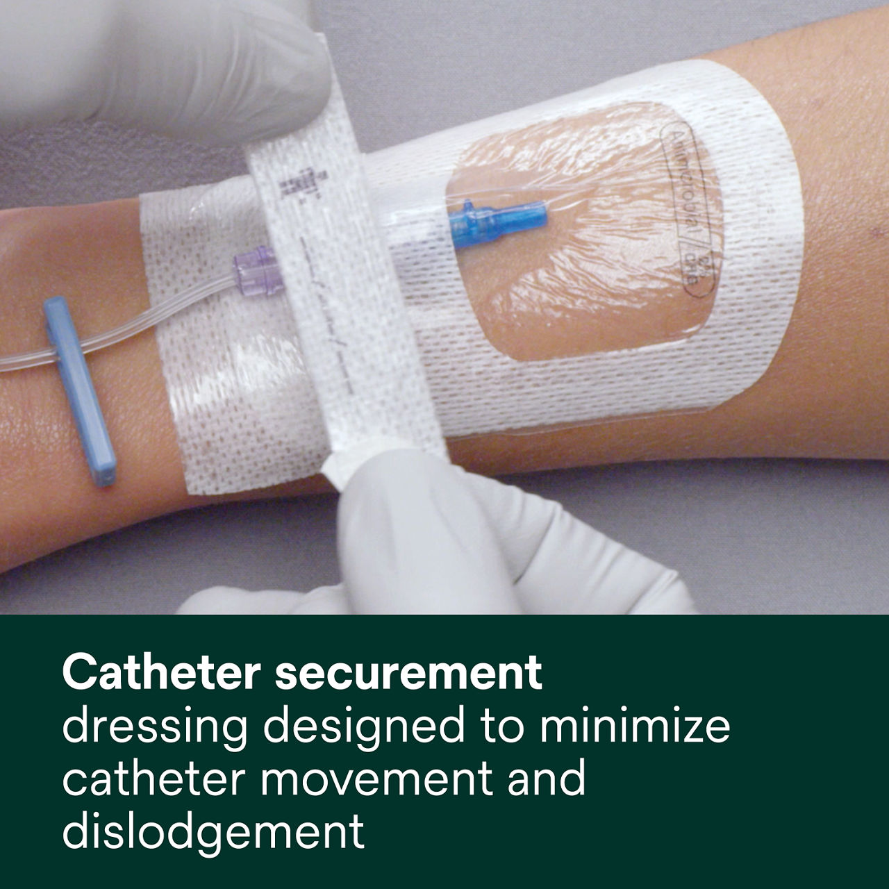 (5) Tegaderm 9132: Catheter securement