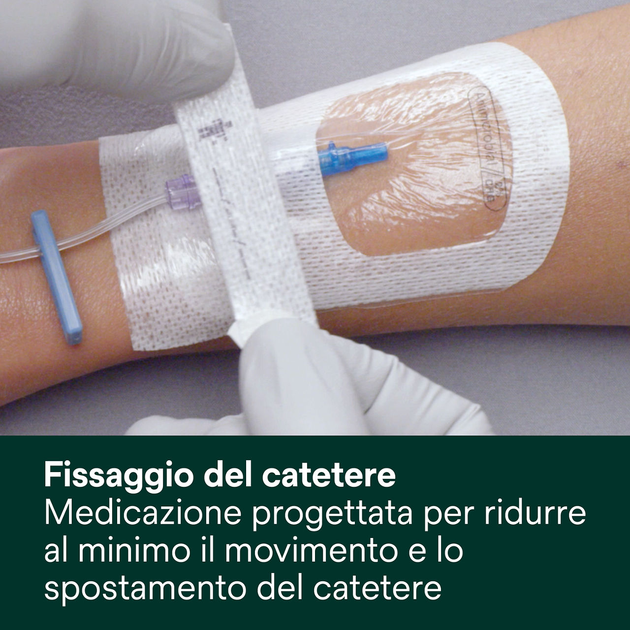 (5) Tegaderm 9132: Fissaggio del catetere