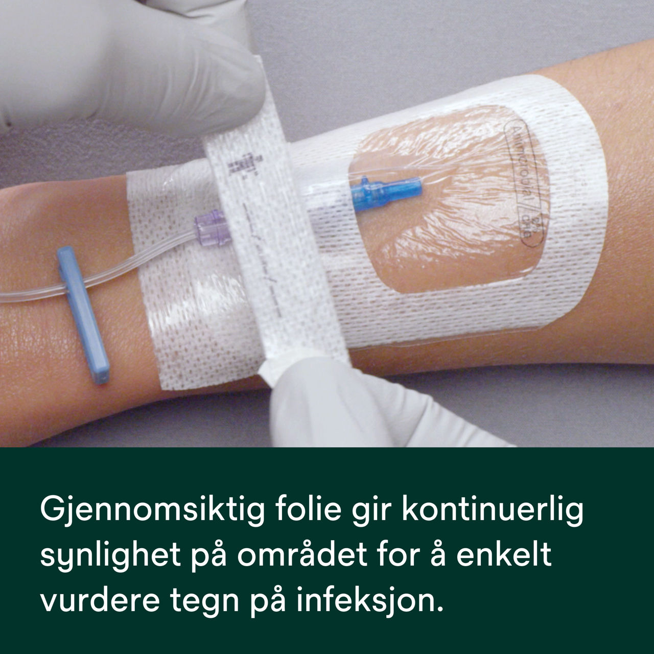 (6) Tegaderm 9132: Kontinuerlig synlighet på stedet