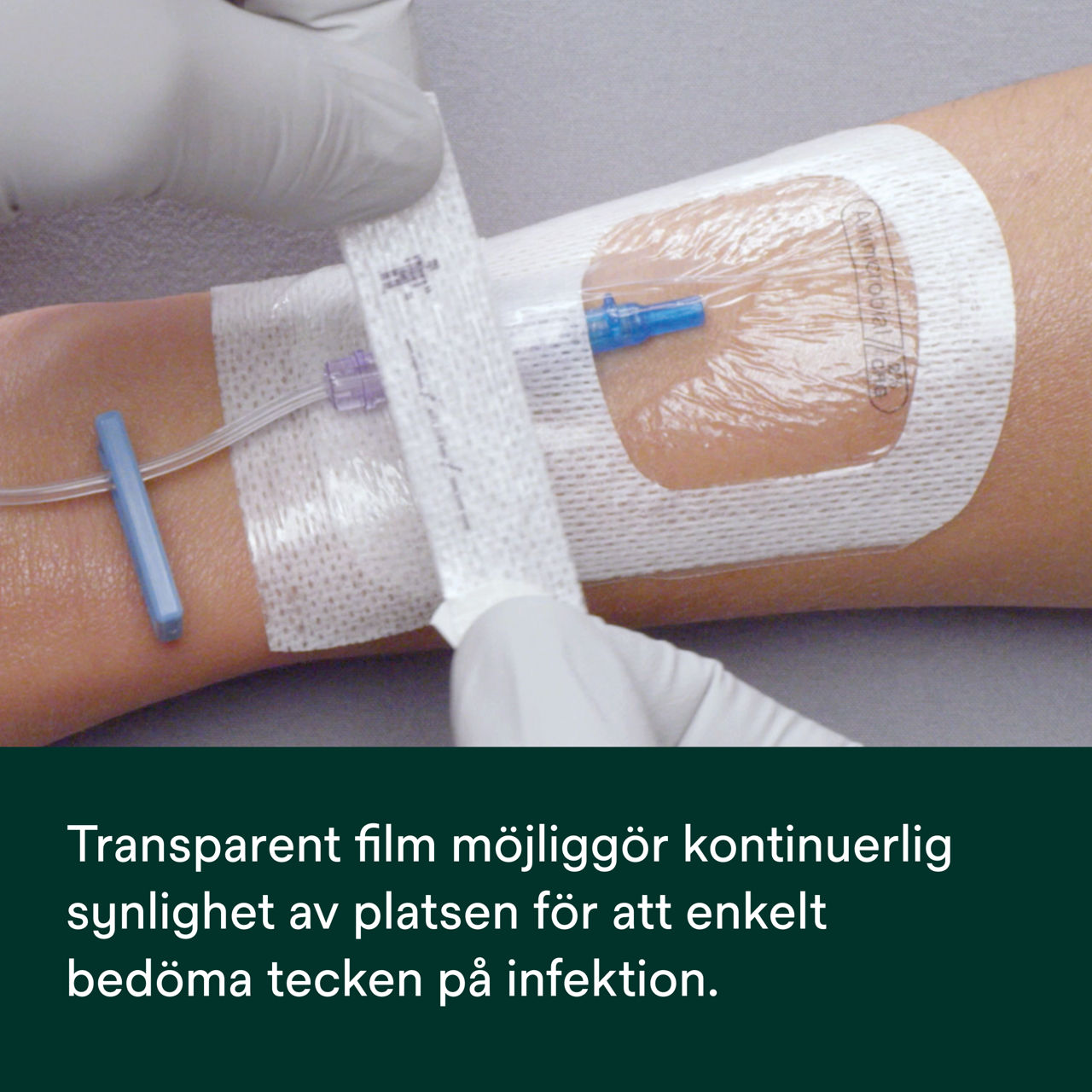 (6) Tegaderm 9132: Kontinuerlig synlighet på platsen