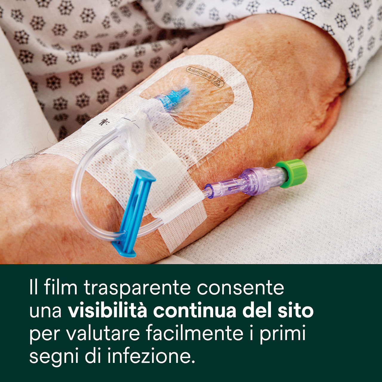 (6) Tegaderm 9132: Visibilità continua del sito