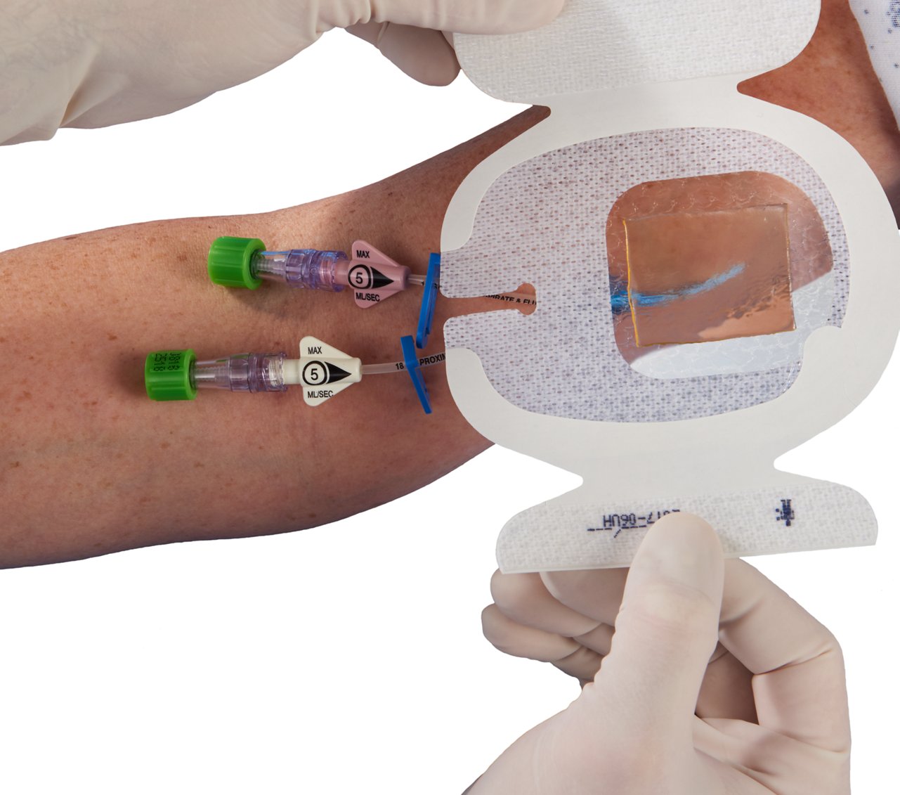 Tegaderm 1657 CHG Dressing, aplicación en el brazo, fondo blanco