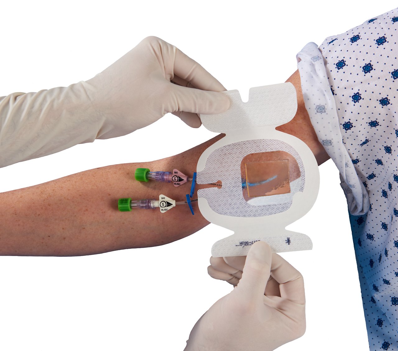 Tegaderm 1657 CHG bandage, anvendelse på arm, hvid baggrund