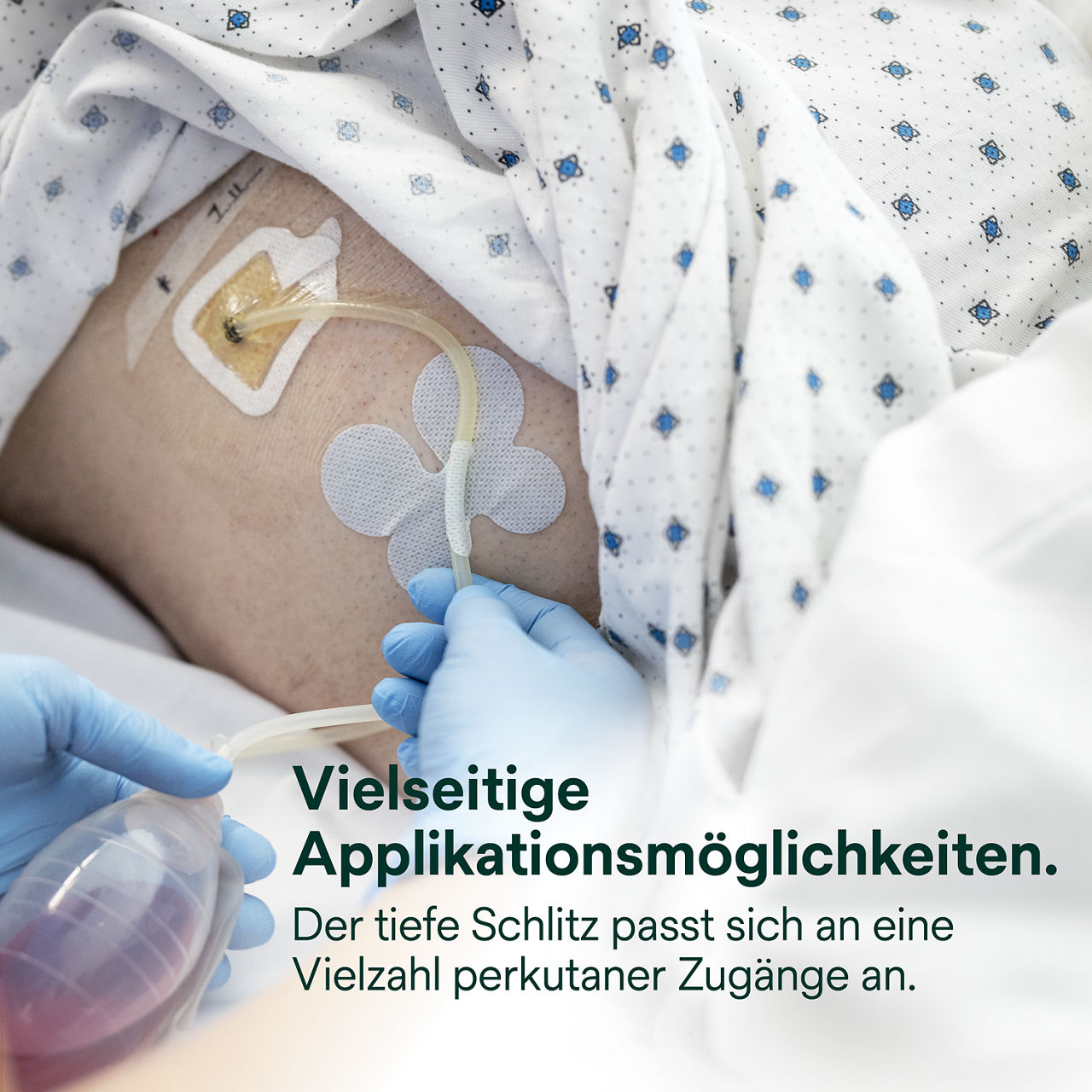 (4) Tegaderm CHG Gelpad 1664/1664R: Vielseitige Anwendung
