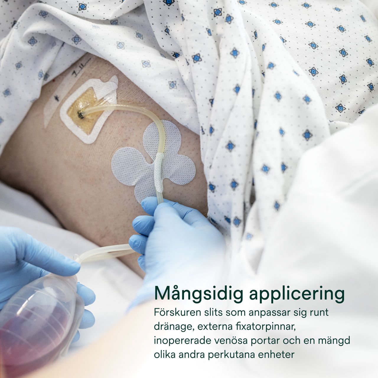 (4) Tegaderm CHG Gel Pad 1664/1664R: Mångsidig applicering