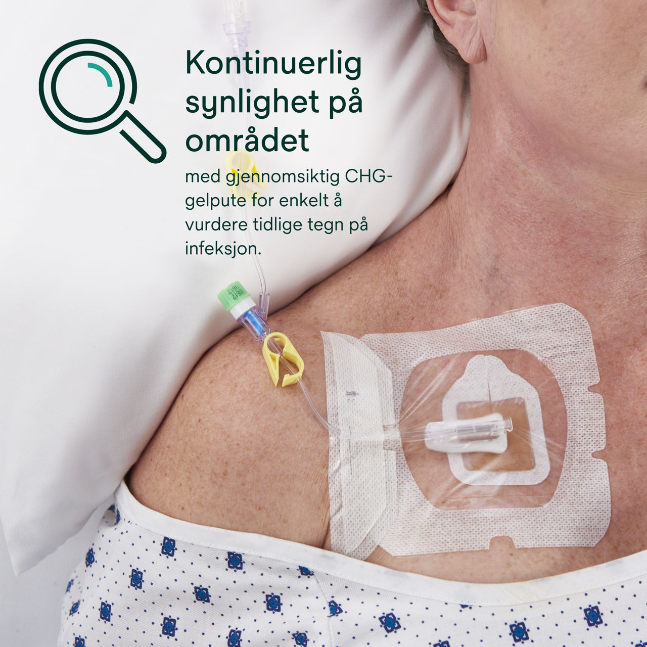 (5) Tegaderm CHG Gel Pad 1664/1664R: Kontinuerlig synlighet på stedet