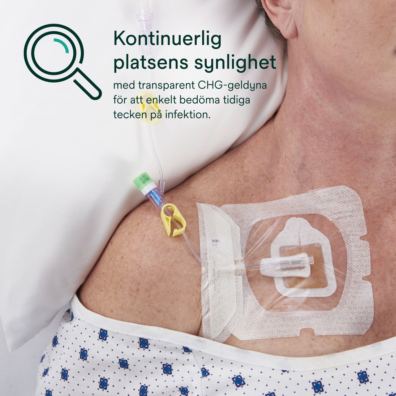 (5) Tegaderm CHG Gel Pad 1664/1664R: Kontinuerlig synlighet på platsen