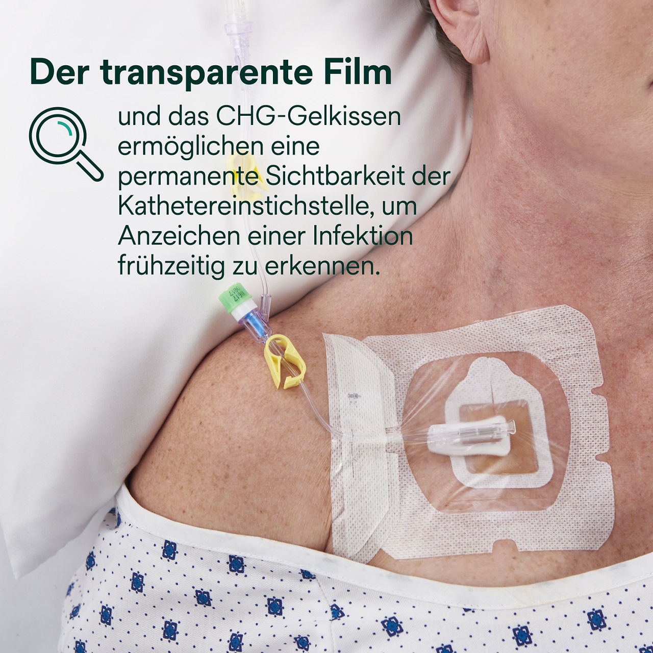 (5) Tegaderm CHG IV-Portverband 1665/1665R: Ständige Sichtbarkeit der Einstichstelle