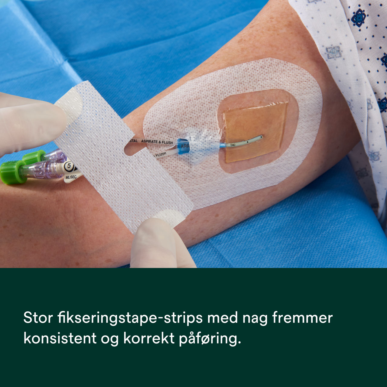 (4) Tegaderm CHG IV Securement 1657: Konsekvent, korrekt påføring