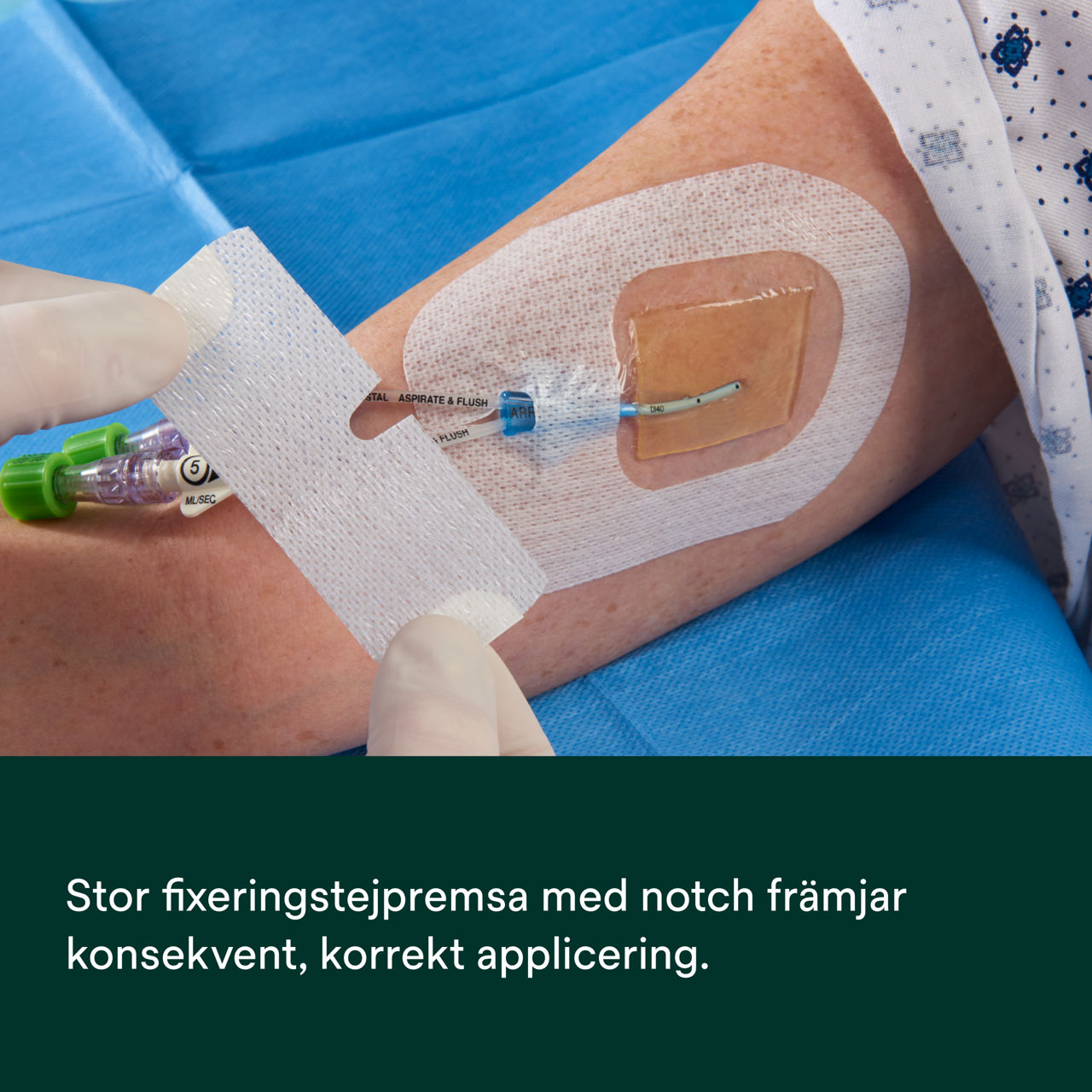 (4) Tegaderm CHG IV Securement 1657: Konsekvent, korrekt applicering