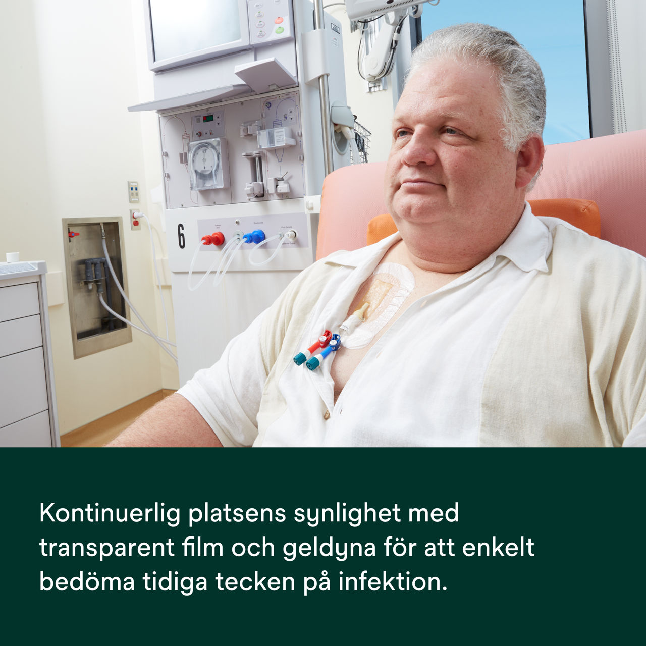 (5) Tegaderm CHG IV Securement 1659: Kontinuerlig synlighet på platsen