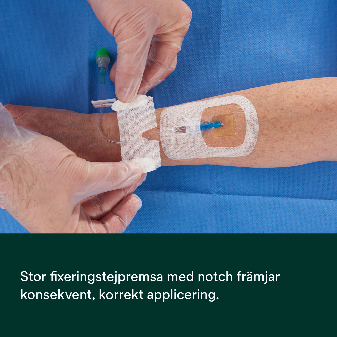 (4) Tegaderm CHG IV Securement 1660: Konsekvent, korrekt applicering