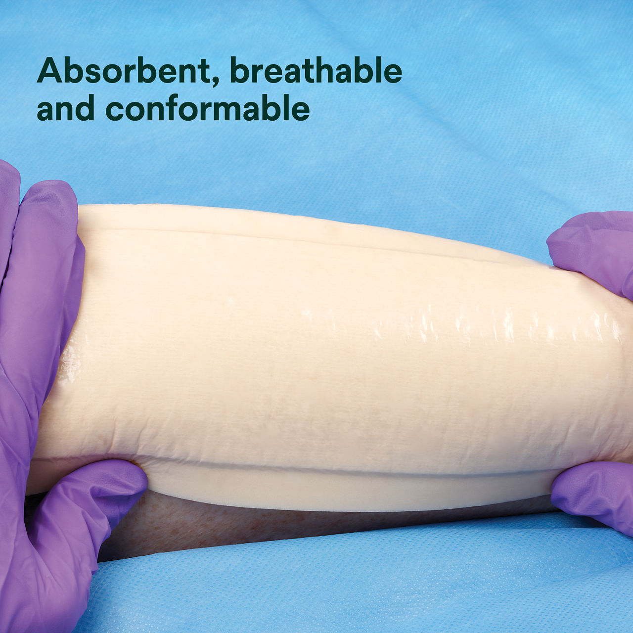 (3) Tegaderm HP Foam Non-Adhesive: Absorbent, breathable and conformable