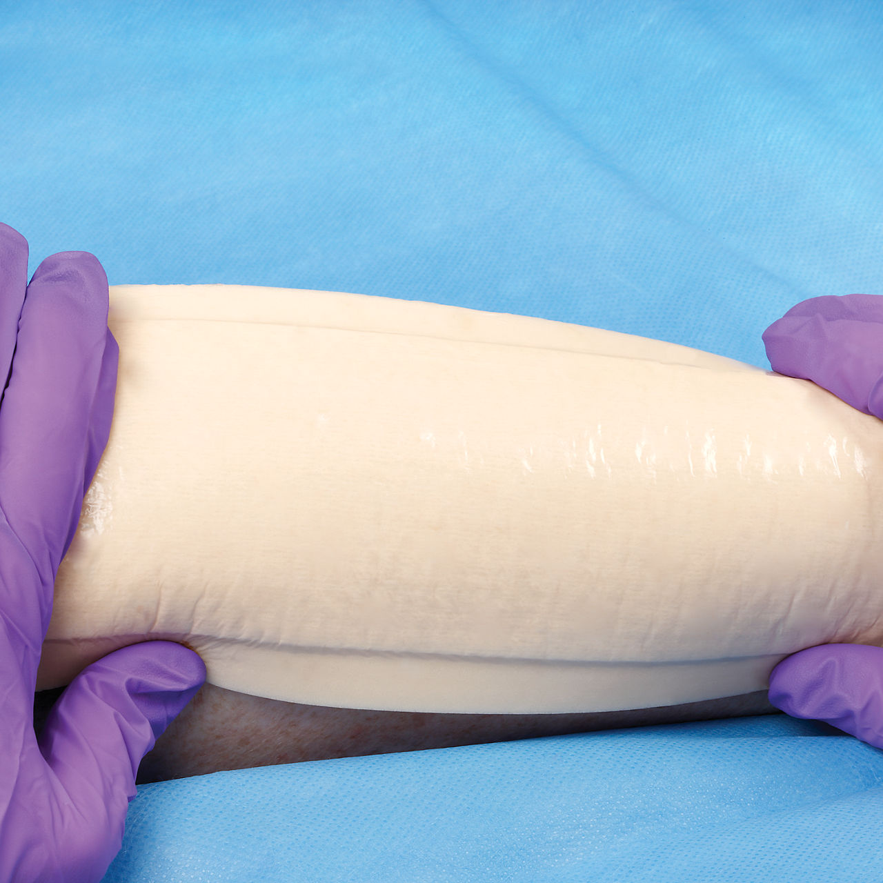 (3) Tegaderm HP 泡棉非黏性：吸收液、透氣且柔軟