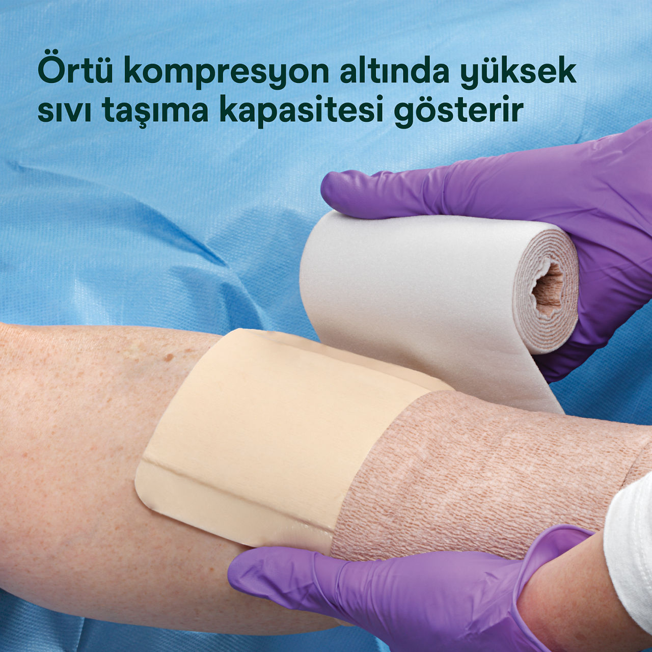 (4) Tegaderm HP Häftande Olmayan Skumförband: Kompression altında yüksek sıvı yönetim kapasitesi