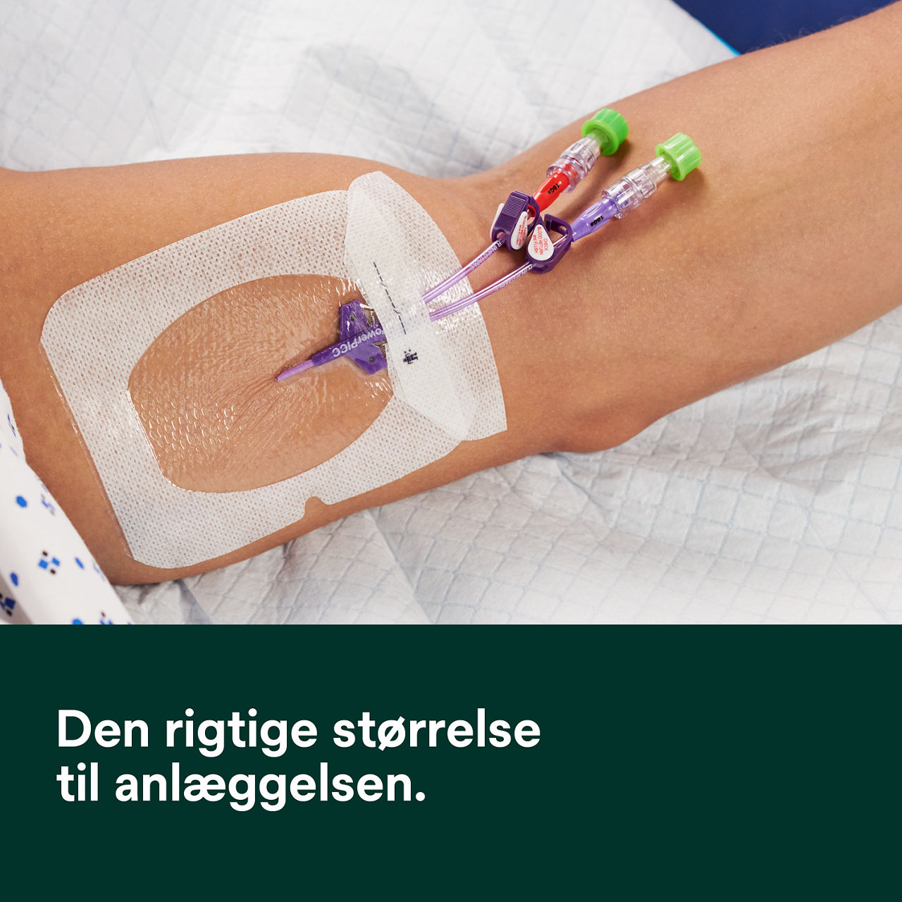 (2-1688) Tegaderm IV Advanced Fiksering: Sikker klæbeevne, synlighed af stedet, håndtering af fugt