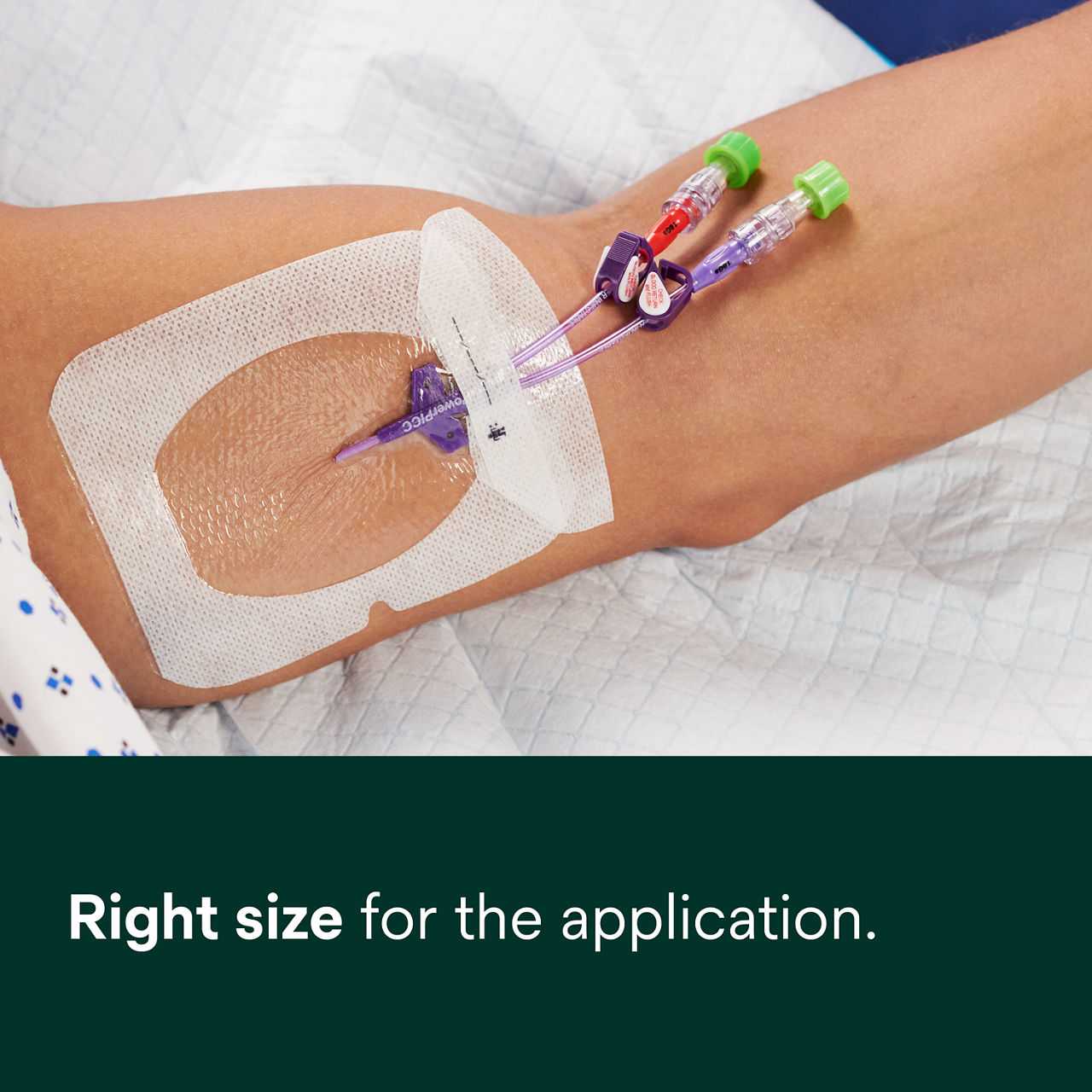 (2 - 1688) Tegaderm IV Advanced Securement: Secure adhesion, site visibility, moisture management