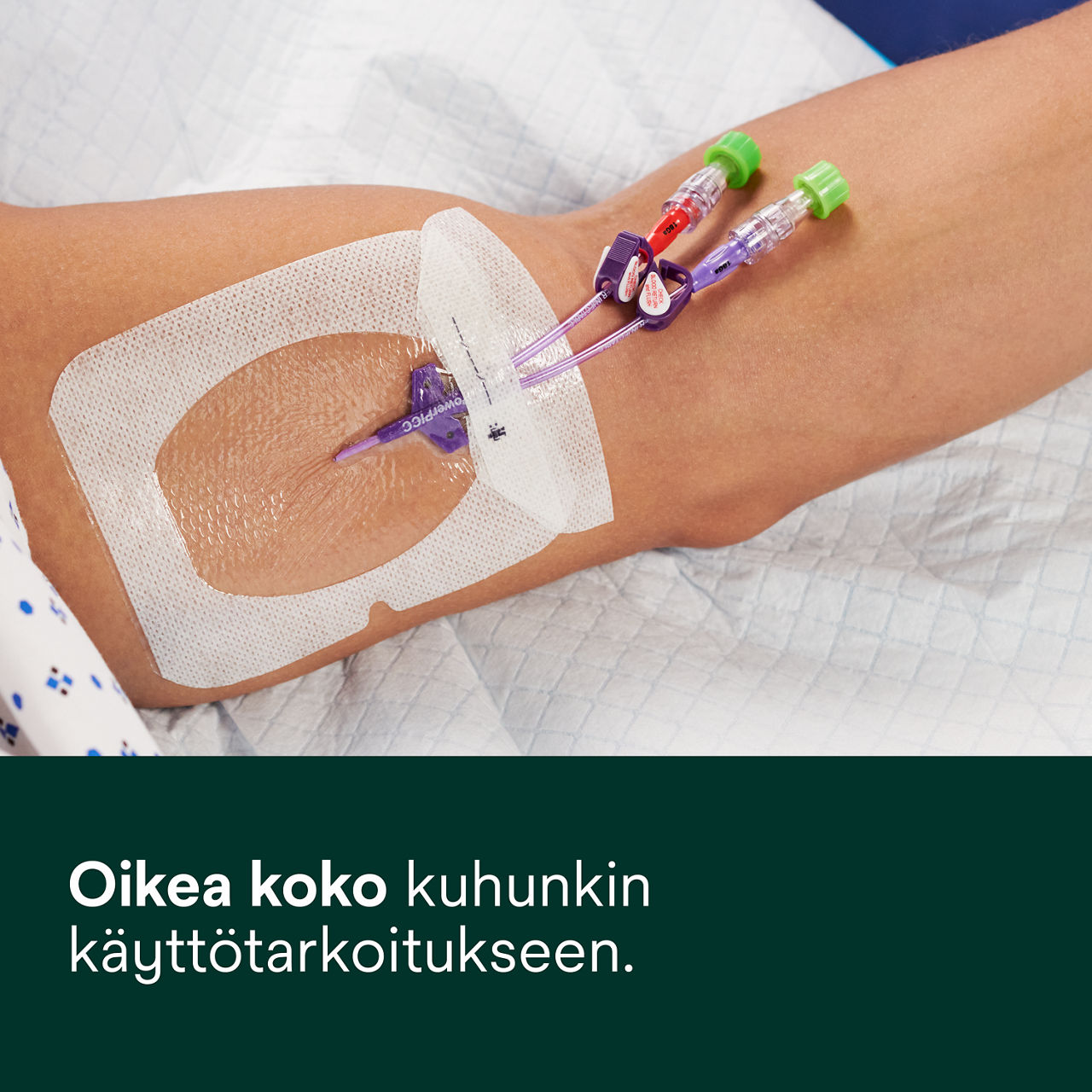 (2 - 1688) Tegaderm IV Advanced Securement: Hyvä tarttuminen, näkyvyys, kosteuden hallinta