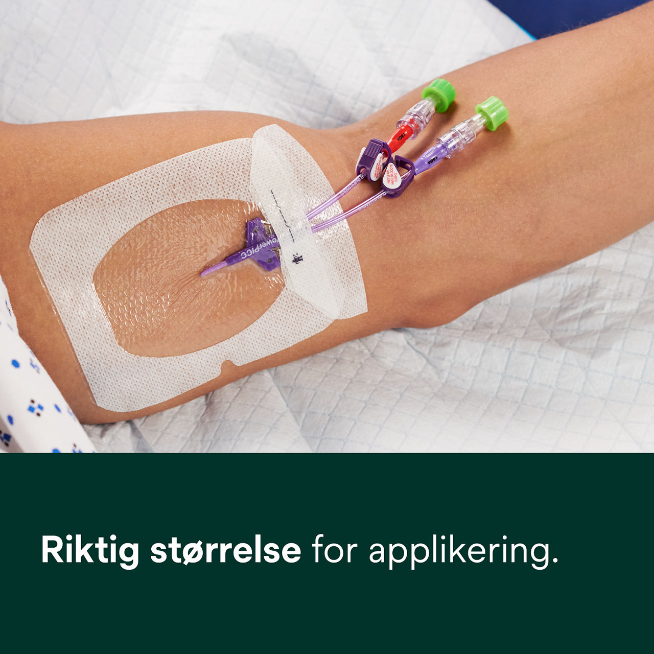 (2 - 1688) Tegaderm IV Advanced Securement: Sikker vedheft, sikt til stedet, fuktighetsstyring