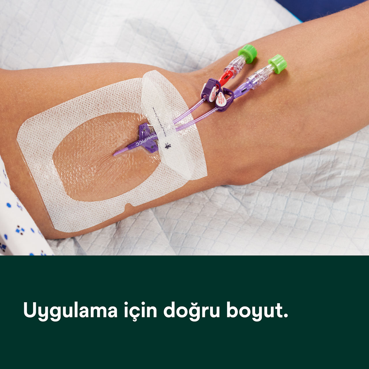 (2 - 1688) Tegaderm IV Gelişmiş Sabitleme: Güvenli adezyon, alan görünürlüğü, nem yönetimi