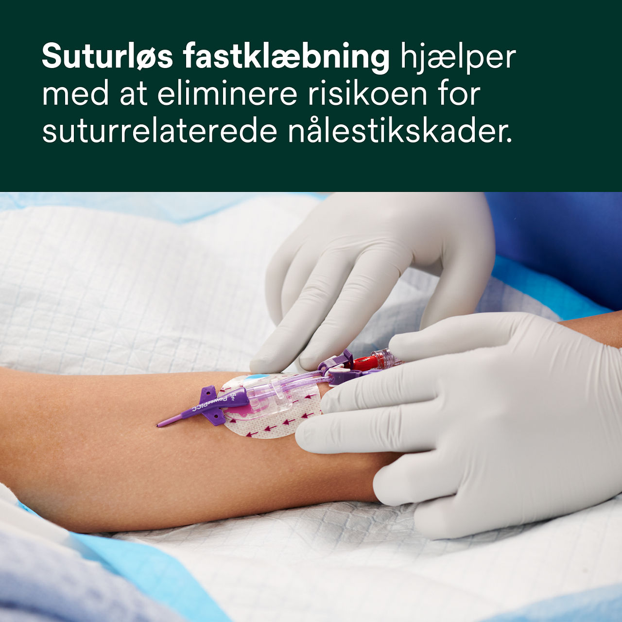 (2) 3M PICC/CVC + Tegaderm IV Advanced Fiksering: Suturfri fiksering