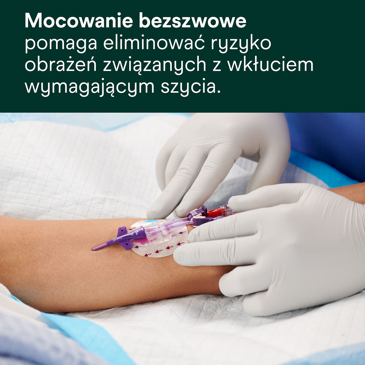 (2) 3M PICC/CVC + Tegaderm IV Advanced Securement: Mocowanie bez użycia szwów