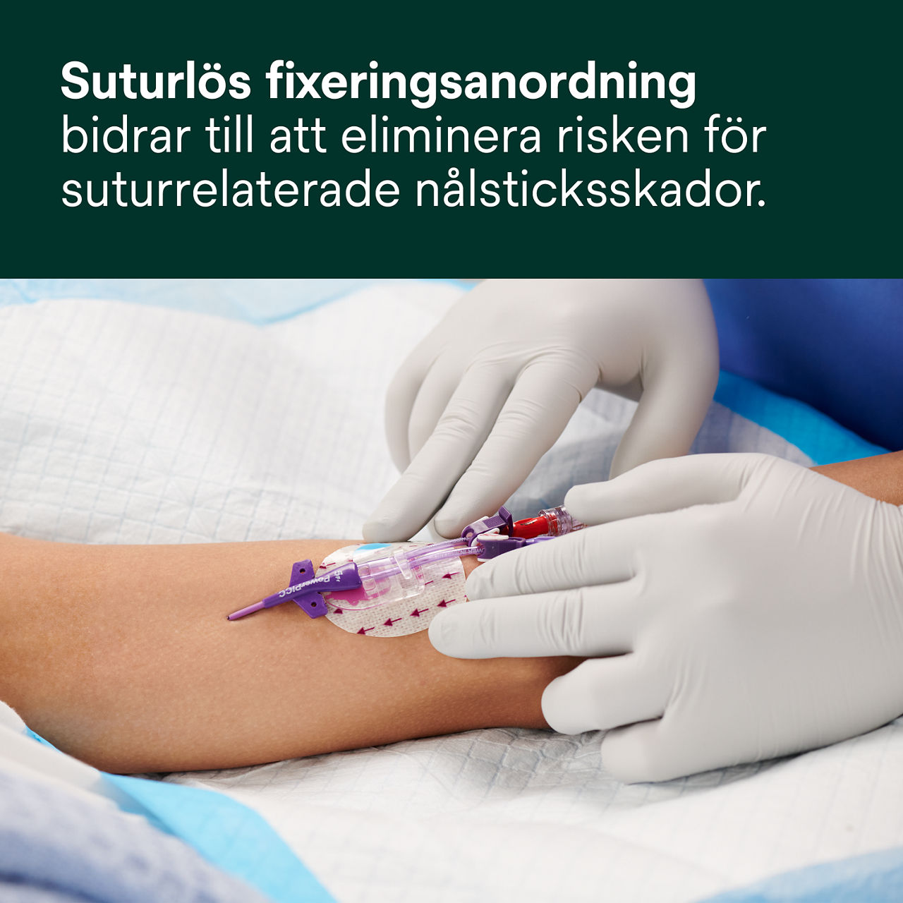 (2) 3M PICC/CVK + Tegaderm IV Advanced Fixering: Suturlös fixering