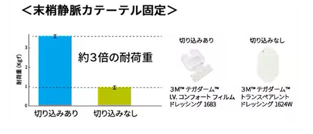 フィルムドレッシング材の切込みの有無による、末梢静脈カテーテル固定の耐荷重比較データです。