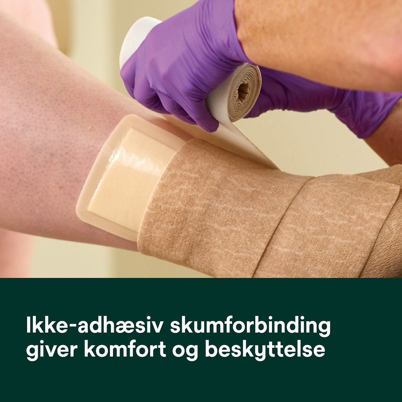 (2) Tegaderm Silikoneskumforbinding: Kan bruges med kompressionsbehandling.