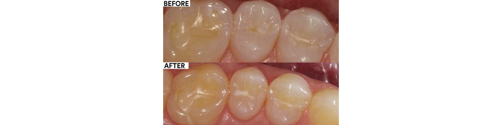 Informative oral care related imagery with a file name of Patricia_Gaton_Fig9_rz.jpg shown on Solventum's "Brain Floss" blog