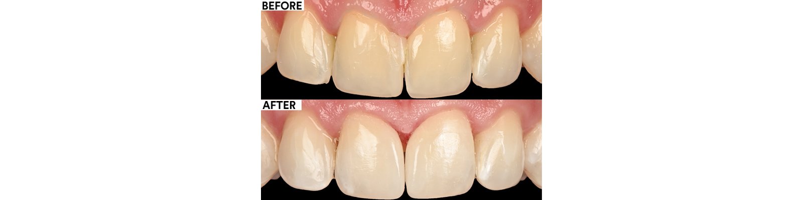 Informative oral care related imagery with a file name of 6_Clark_Dental_duct_tape.jpg shown on Solventum's "Brain Floss" blog