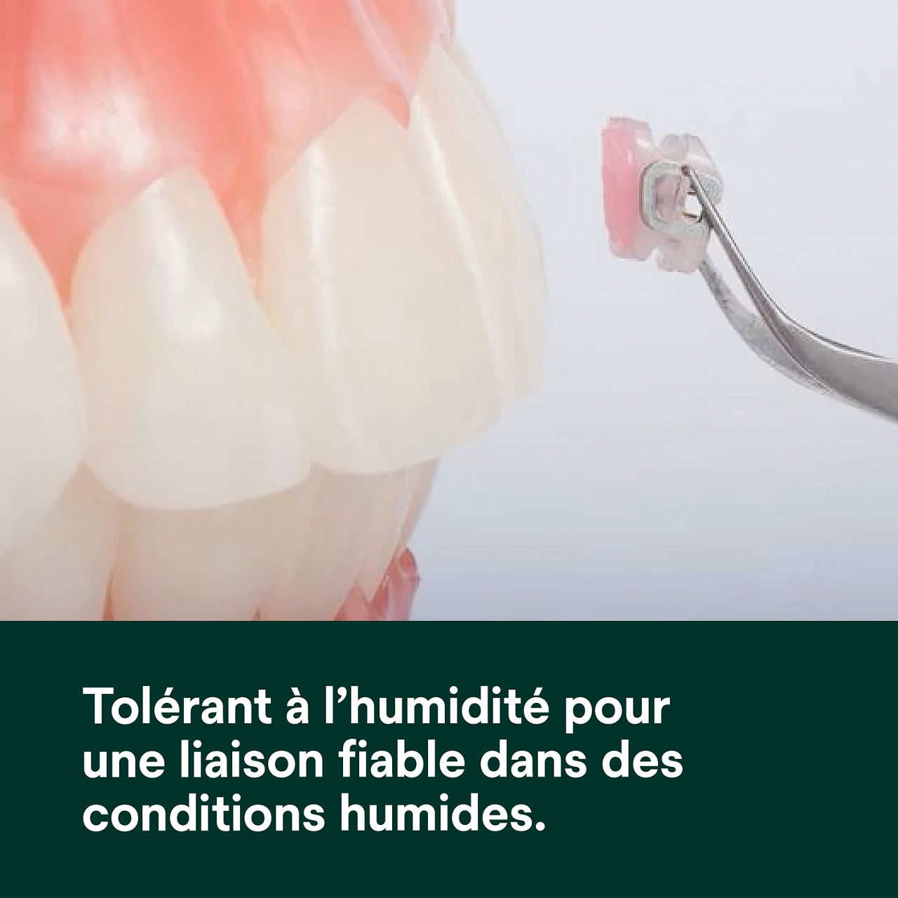 (2) Adhésif Transbond Plus à changement de couleur Tolérant à l'humidité pour un collage fiable