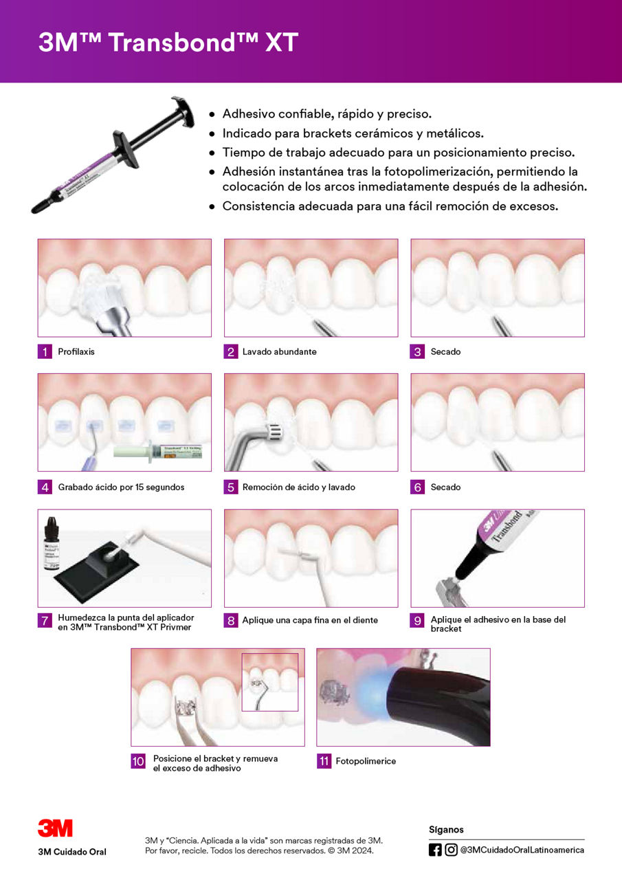 Transbond XT Protocolo de adhesión