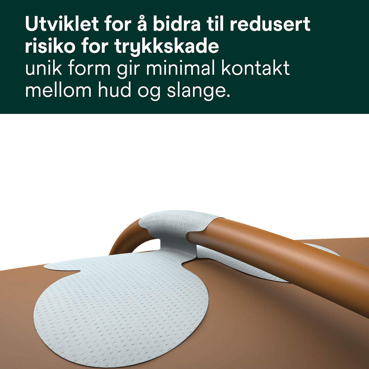 (1) Rørfikseringsenhet: Designet for å redusere risikoen for trykksår