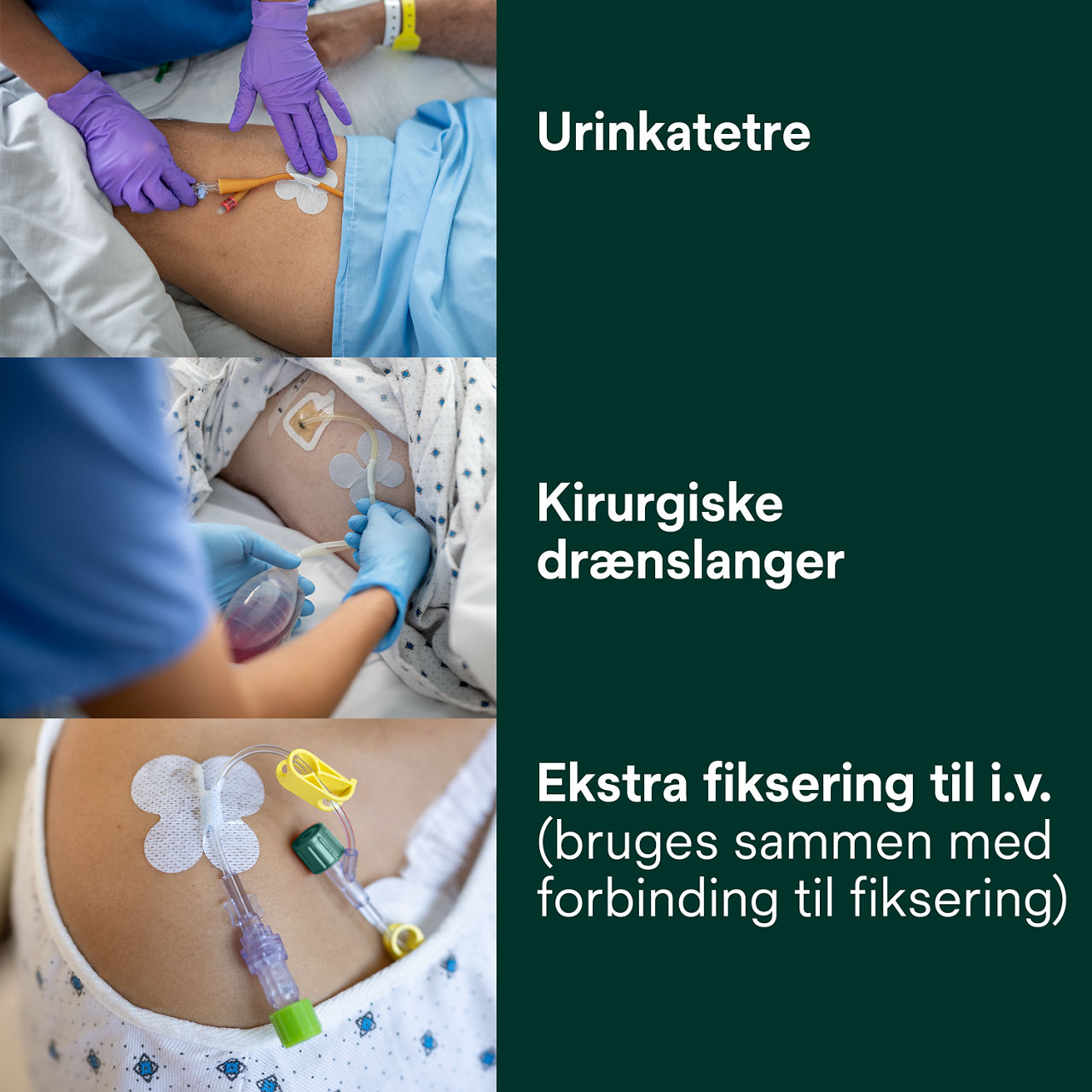 (3) Sikkerhedsanordning til rør: Urinkatetre, operationsdræn, ekstra fiksering til IV'er