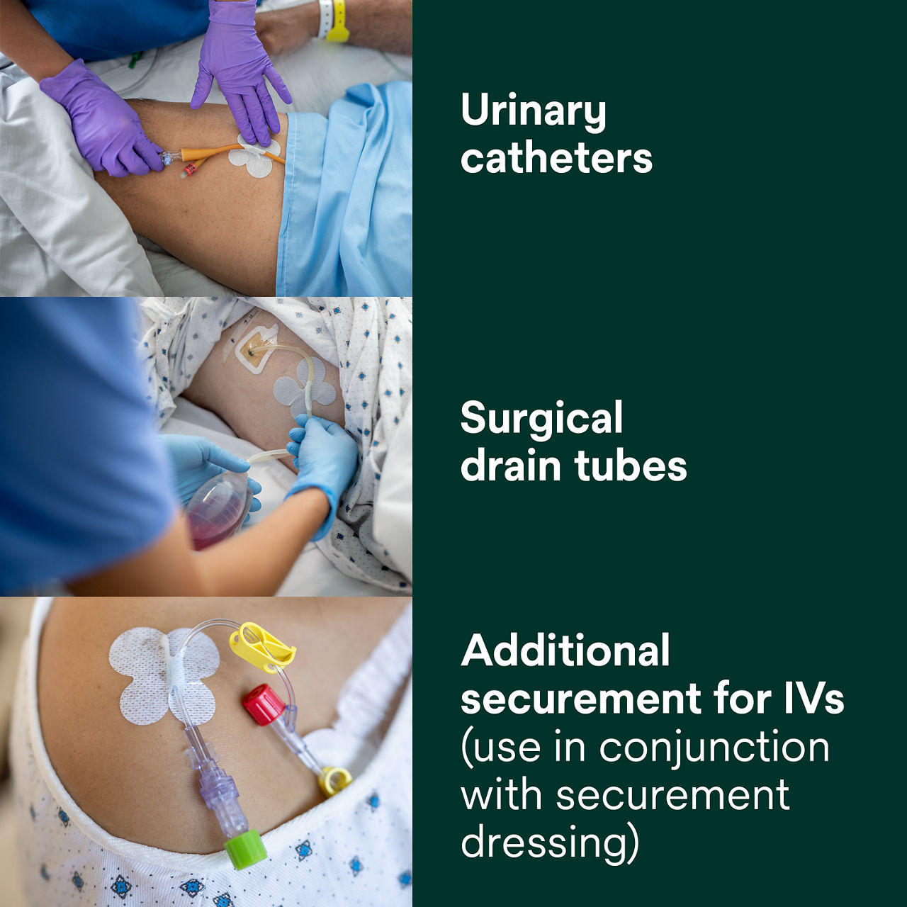 (3) Tube Securement Device: Urinary catheters, Surgical drain tubes, Additional securement for IVs