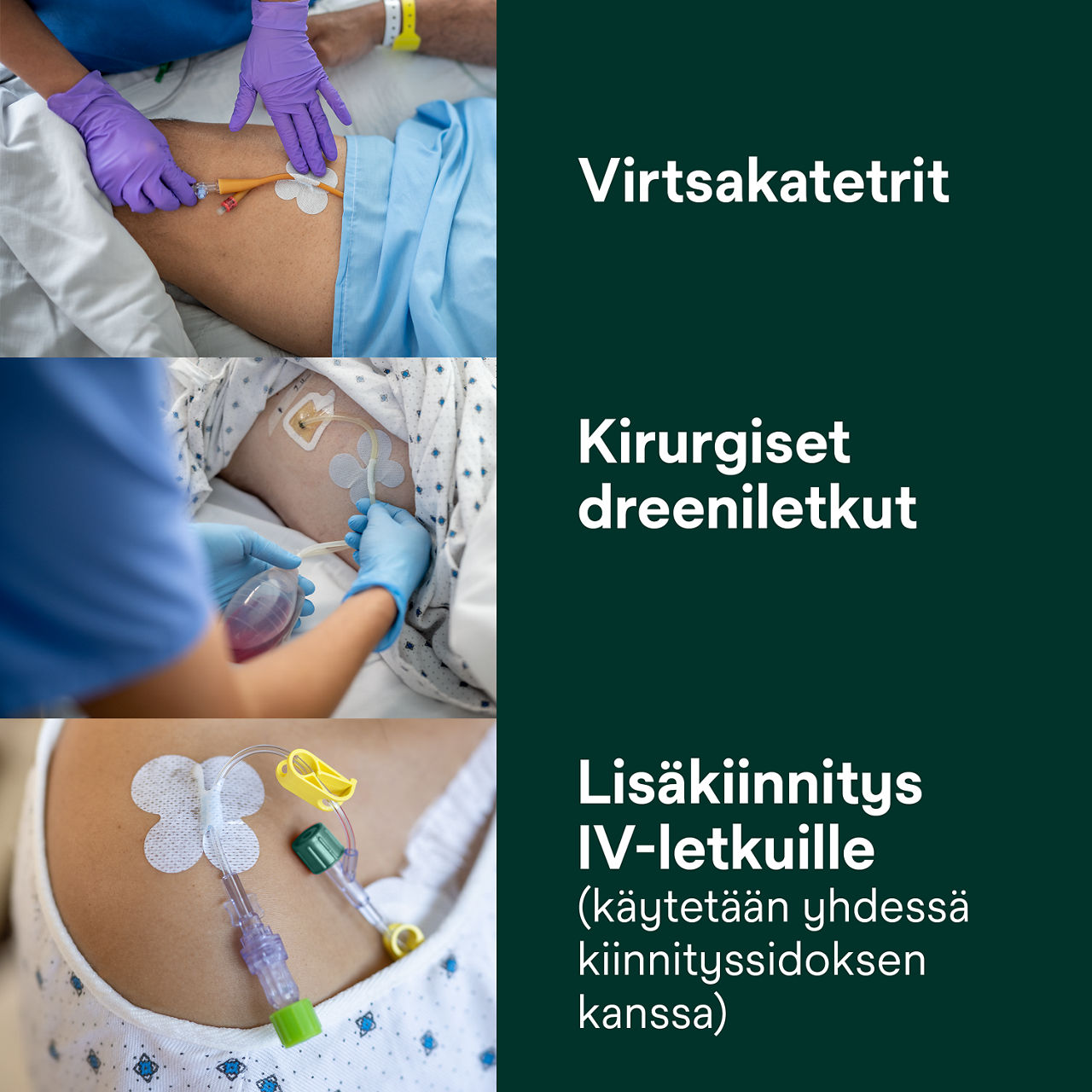 (3) Letkun kiinnitystarvike: Virtsakatetrit, kirurgiset dreeniputket, lisäkiinnitys IV:lle