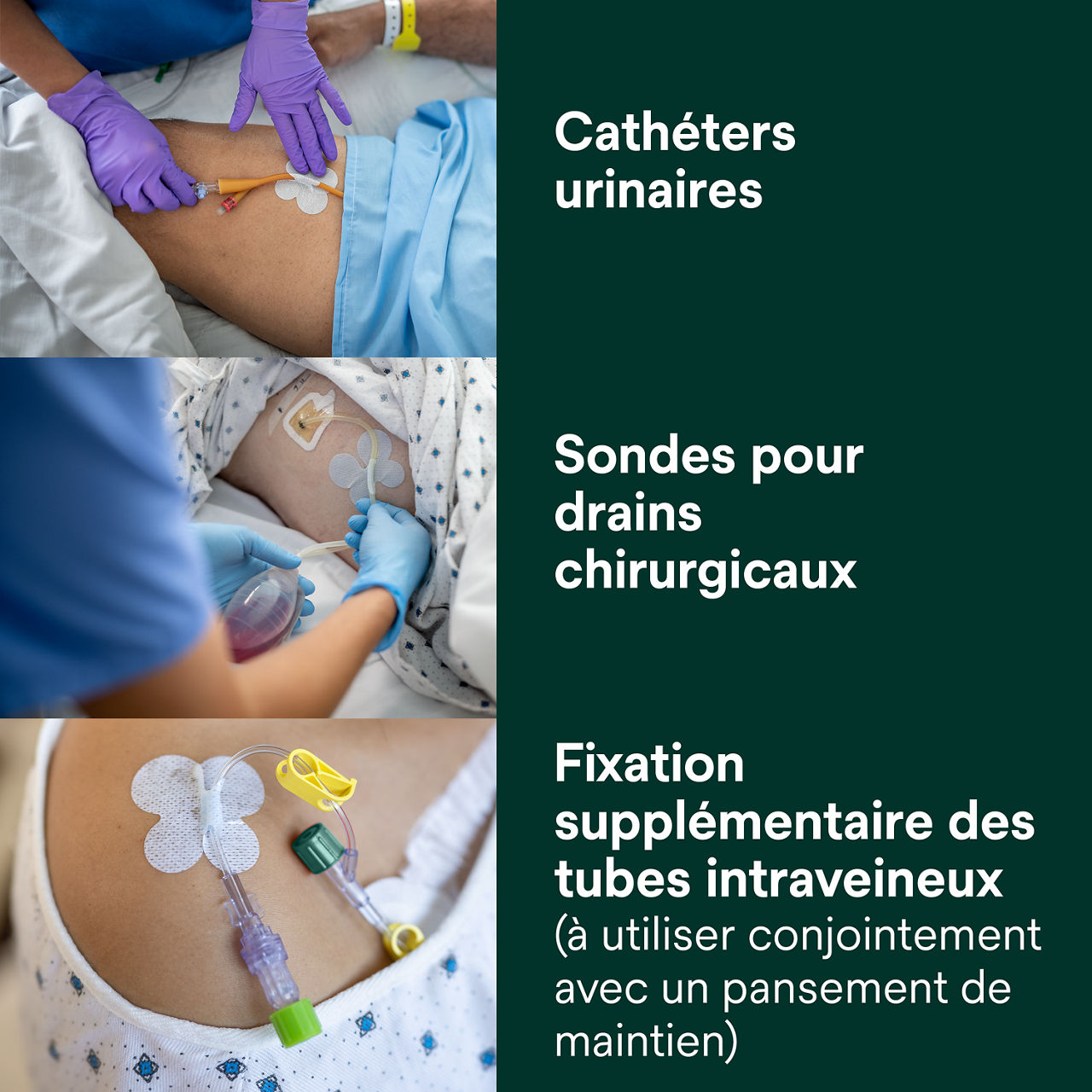 (3) Dispositif de fixation de tube : Cathéters urinaires, drains chirurgicaux, fixation supplémentaire pour IVs