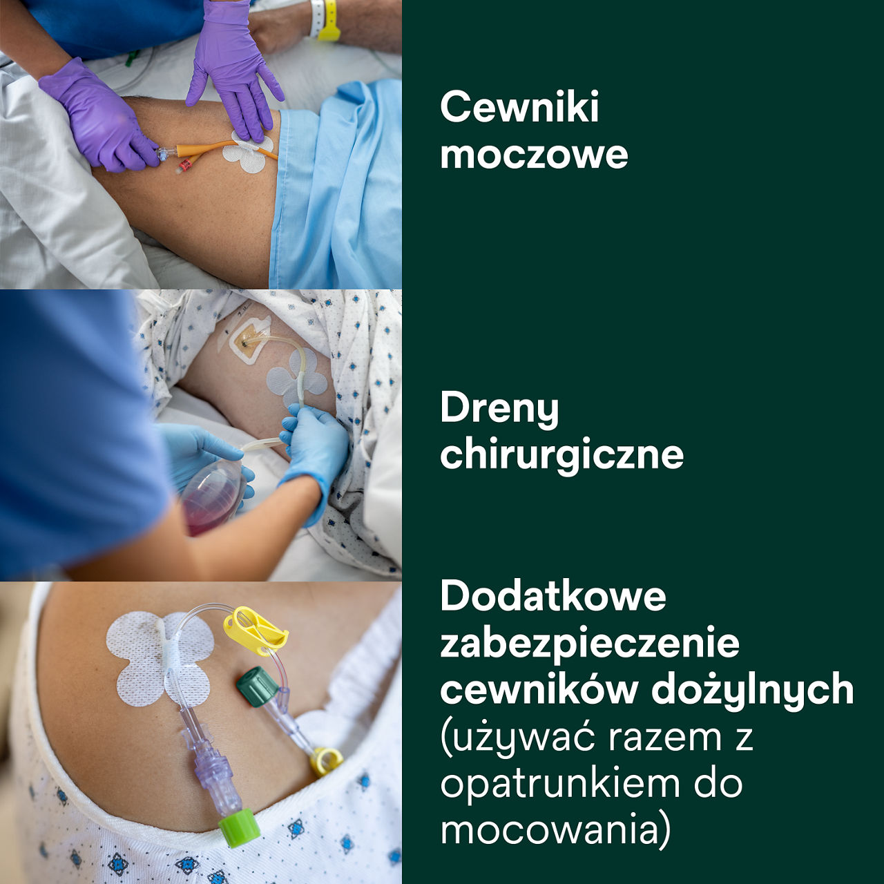 (3) Urządzenie do mocowania rurki: Cewniki moczowe, dren chirurgiczny, dodatkowe mocowanie dla kroplówek