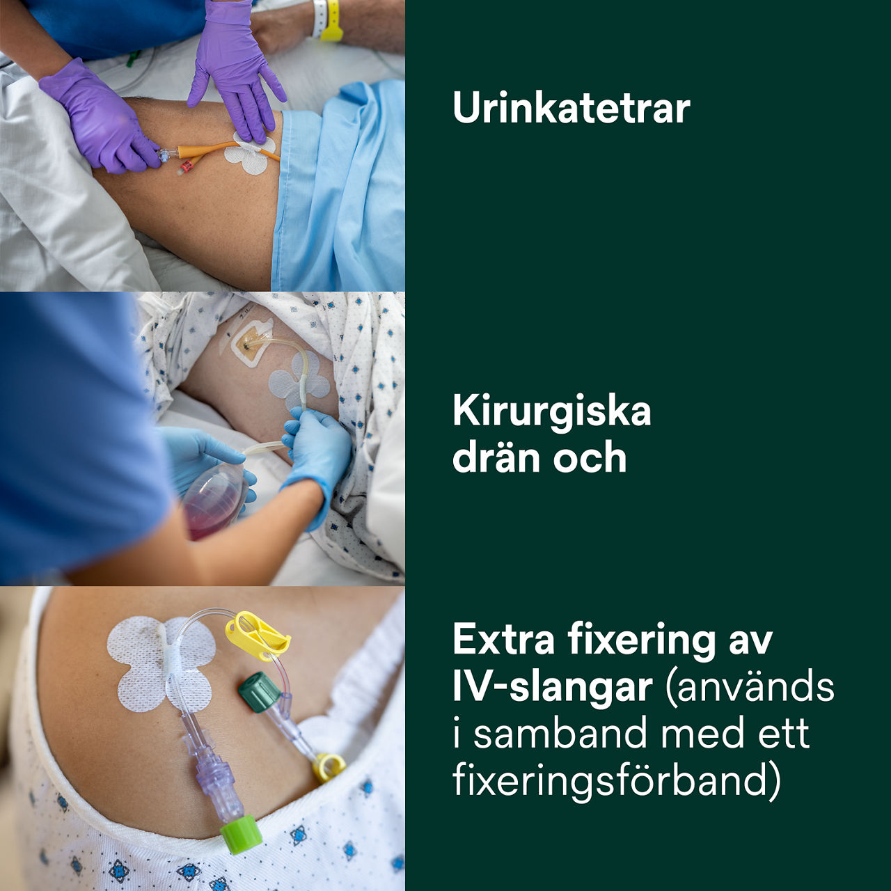 (3) Rörfixeringsenhet: Urinkatetrar, Kirurgiskt dränagerör, Ytterligare fixering för IV