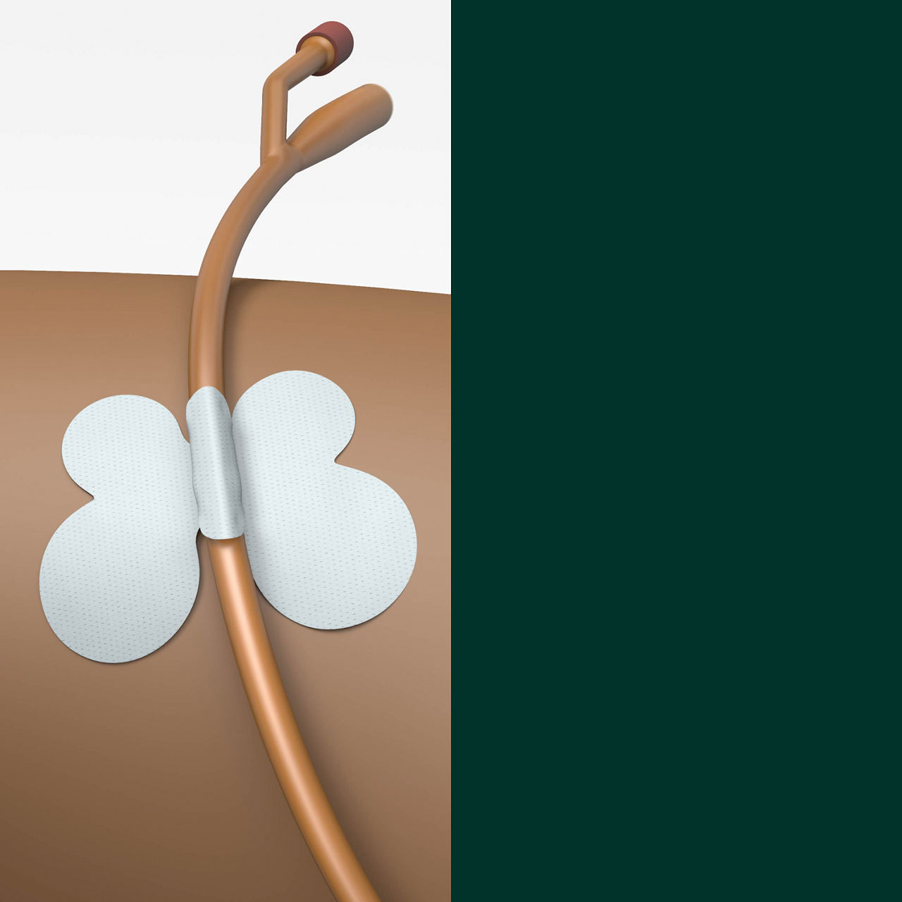 (4) Dispositivo de Fijación de Tubos: Fijación confiable