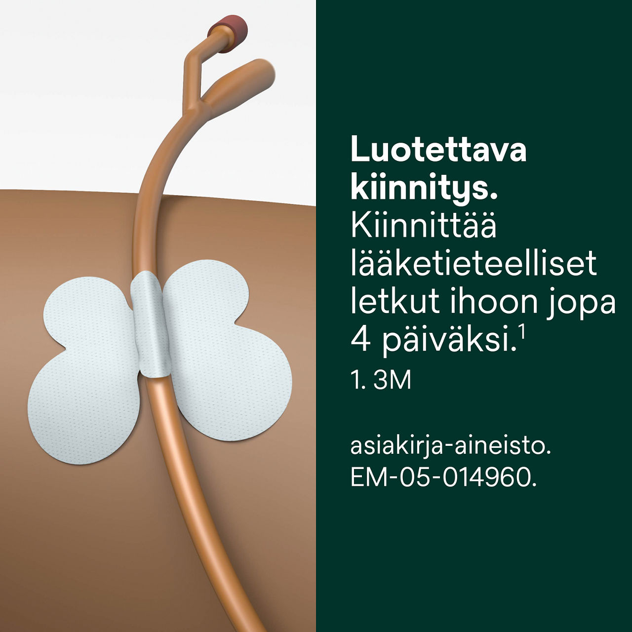 (4) Letkun kiinnitystarvike: Luotettava kiinnitys
