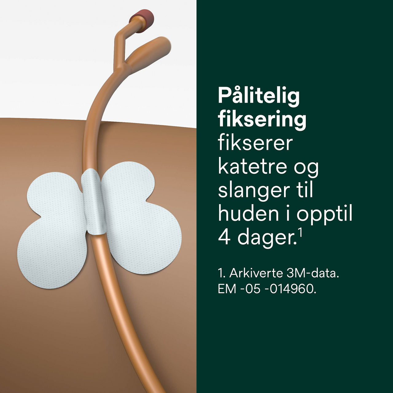 (4) Rørfikseringsenhet: Pålitelig fiksering
