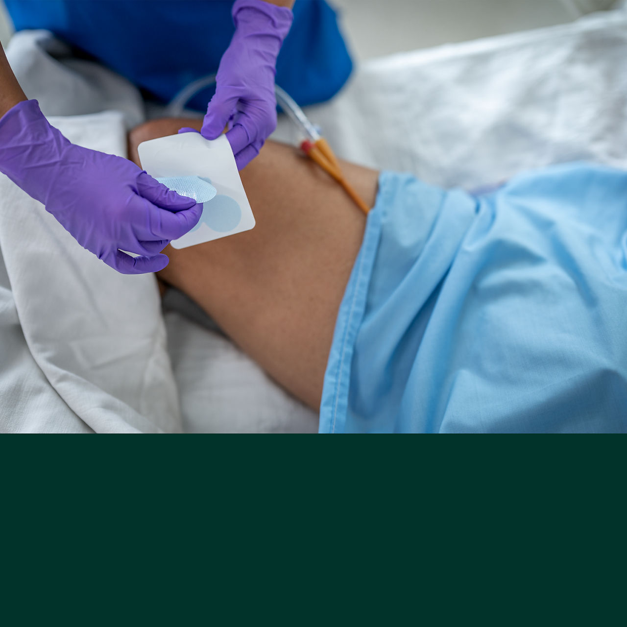 (5) Tüp Sabitleme Cihazı: Uygulaması kolay ve çıkarma ajanı olmadan temiz bir şekilde çıkarılır