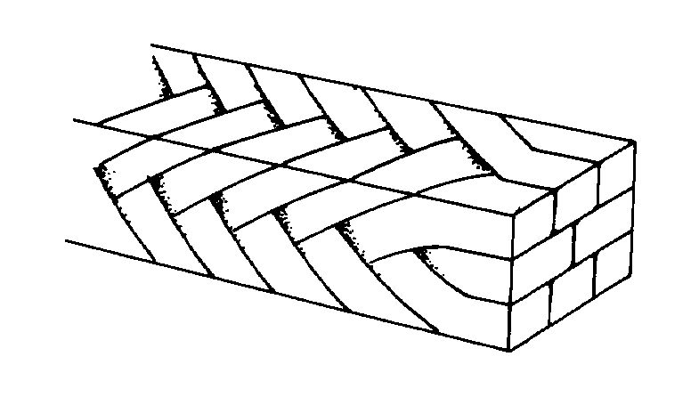 3M™ Unitek™ Braided Archwire 300-914, .019x.025, OrthoForm™ II Square,Lower, 10/Pk