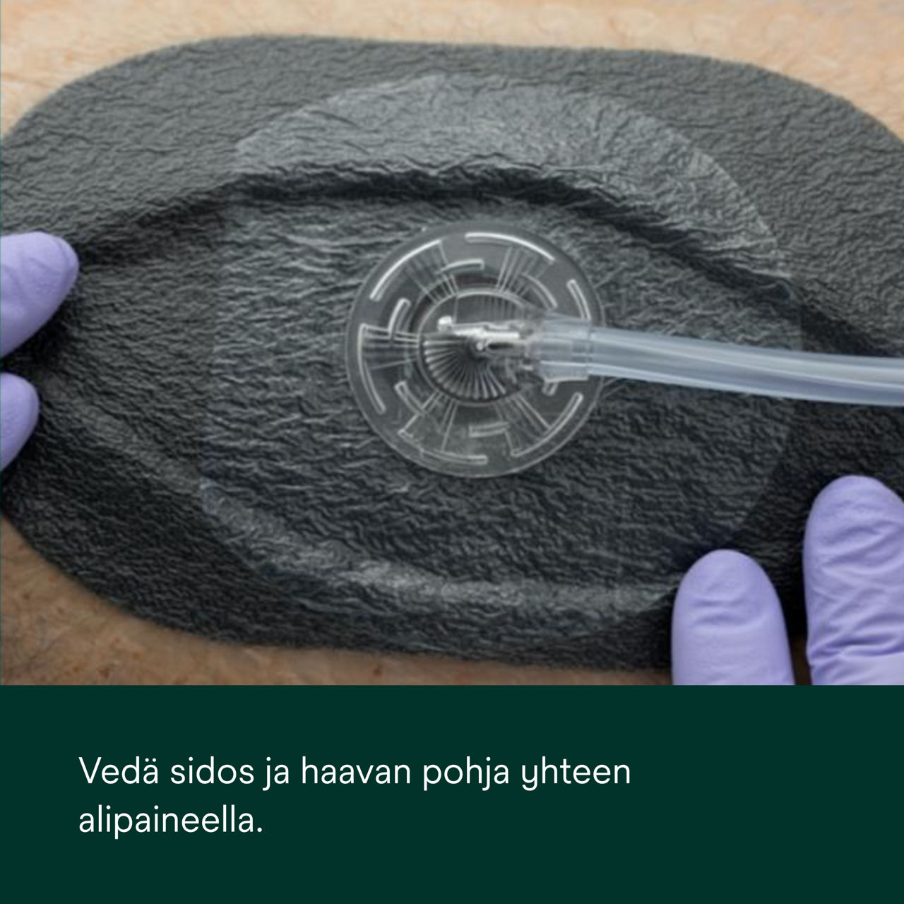 1: V.A.C. Peel and Place - Peitä haava ja haavan ympäröivä iho.