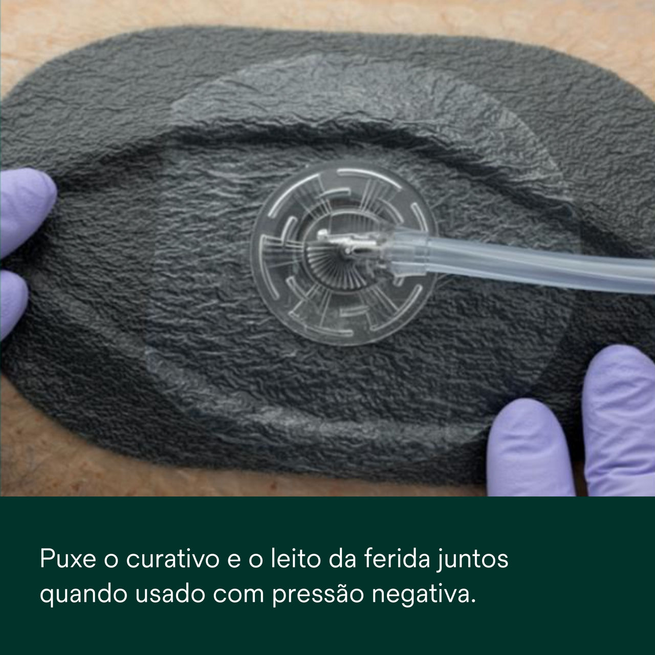 1: V.A.C. Peel and Place - Cubra o leito da ferida e a pele ao redor da ferida.