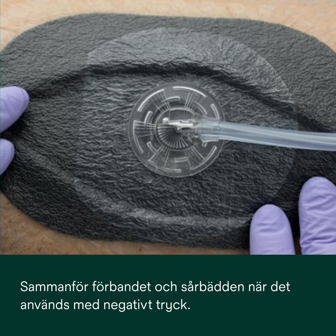 2: V.A.C. Peel and Place – Dra ihop förbandet och sårbädden.